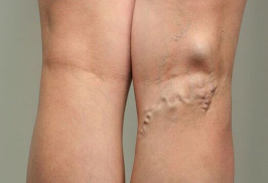 Veins