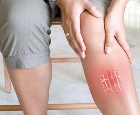 Dysfunction of venous blood circulation in the lower limb