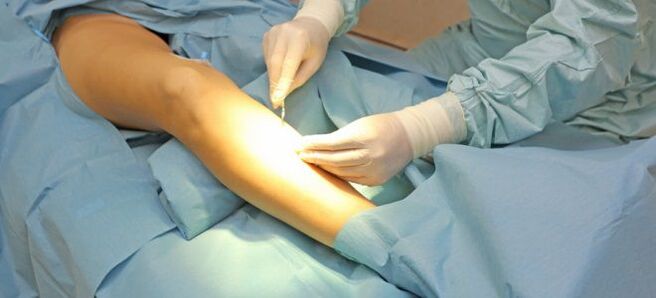 Surgical method